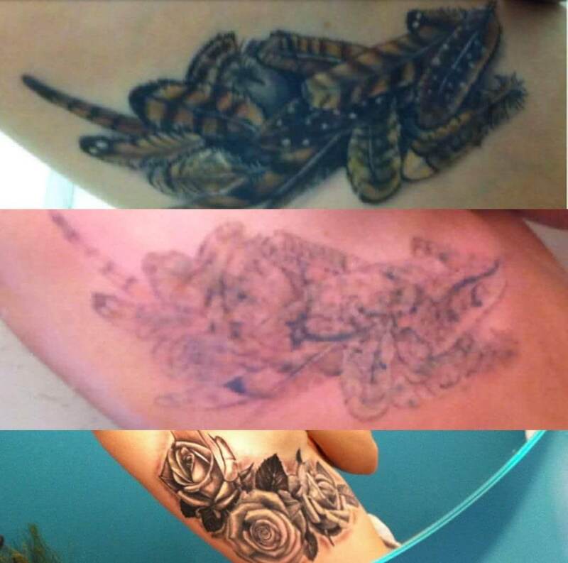Tattoo removal before and after result 13