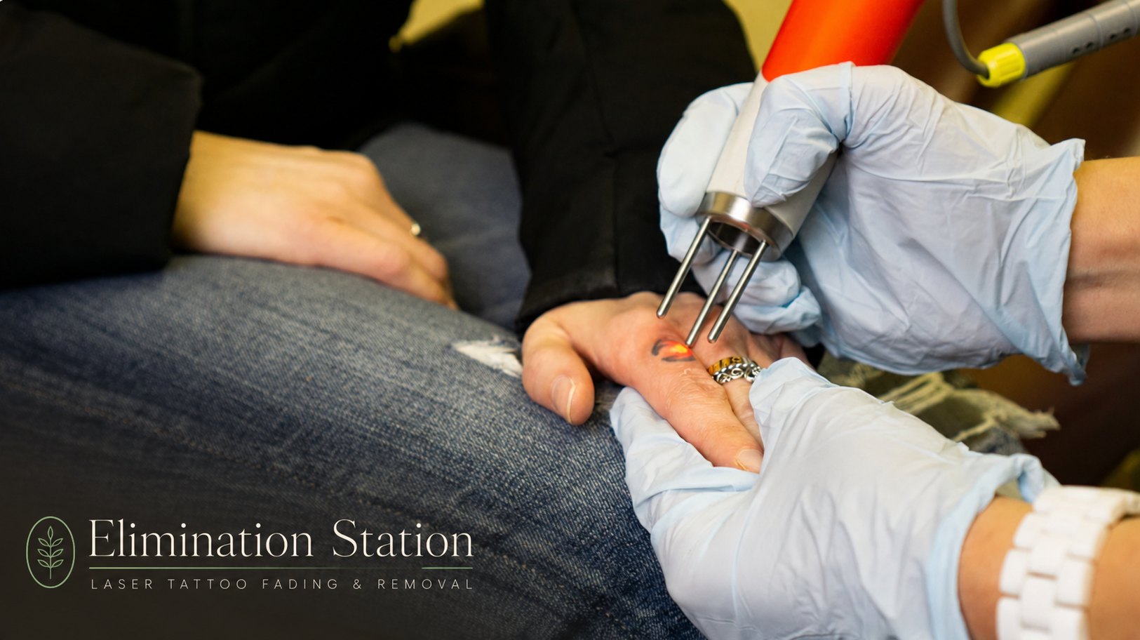 An Elimination Station technician performing a laser tattoo removal treatment on a client's forearm.